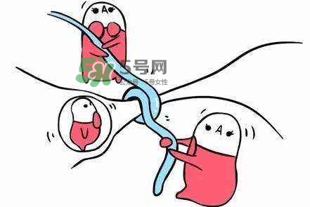 結(jié)扎好還是上環(huán)好？結(jié)扎上環(huán)哪個危害小？