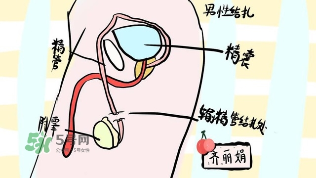 生完二胎一定要結扎嗎？生完二胎結扎好不好？