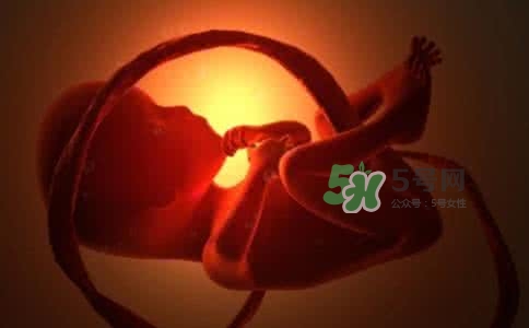 寶寶臍帶繞頸只能剖腹產(chǎn)嗎？胎兒臍帶繞頸孕婦有什么感覺