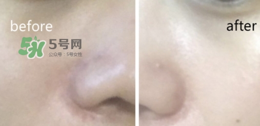 hr綠寶瓶新肌水怎么用？赫蓮娜綠寶瓶新肌水使用方法