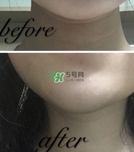 olay小白瓶有哪些版本？olay小白瓶版本區(qū)別