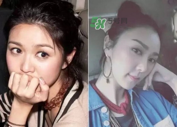 發(fā)際線低怎么調(diào)整？標(biāo)準(zhǔn)的發(fā)際線圖片