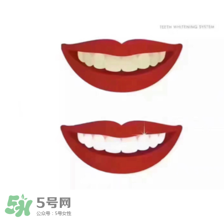美牙儀能帶上飛機(jī)嗎？美牙儀可以過安檢嗎？
