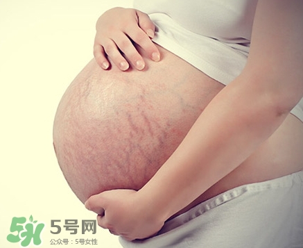 孕婦胸部長(zhǎng)妊娠紋嗎？胸部長(zhǎng)妊娠紋了怎么辦？