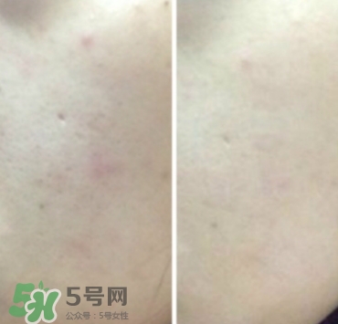 美康粉黛氣墊bb怎么樣？美康粉黛氣墊bb毀容