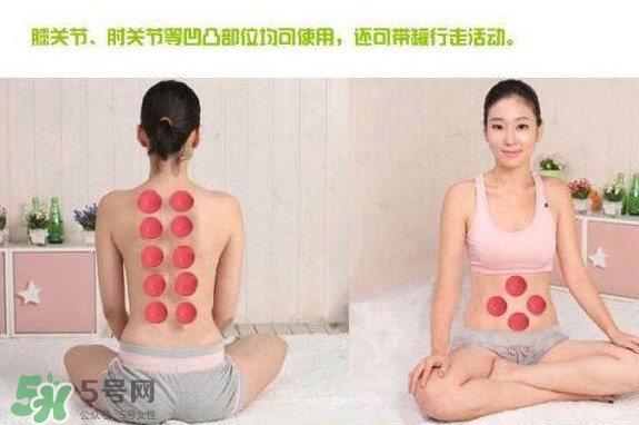 火罐和真空罐哪個好？真空罐和火罐效果一樣好嗎