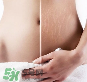 妊娠紋什么時候變白？妊娠紋產(chǎn)品什么時候用？