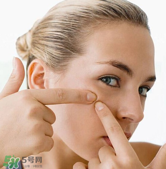 長(zhǎng)痘長(zhǎng)閉口怎么辦？長(zhǎng)痘長(zhǎng)閉口是什么原因？