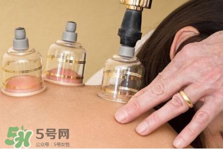 真空拔罐有用嗎？真空拔罐多長(zhǎng)時(shí)間合適