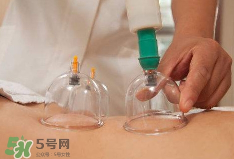 真空拔罐有用嗎？真空拔罐多長(zhǎng)時(shí)間合適