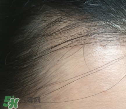 發(fā)際線粉要卸妝嗎_怎么卸？