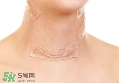 硅膠疤痕貼有用嗎？硅膠疤痕貼效果怎么樣？