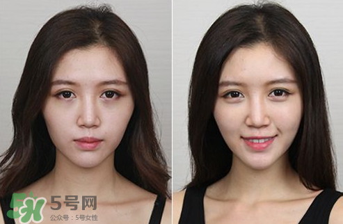 蘋果肌怎么化？蘋果肌究竟哪里好？