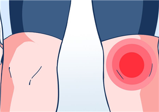 風(fēng)濕可以泡腳嗎？風(fēng)濕可以泡溫泉嗎？
