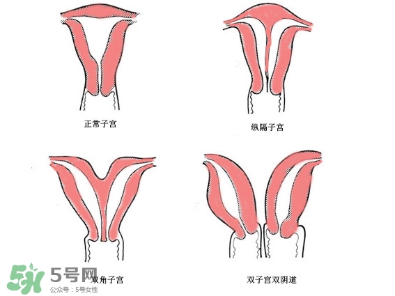 雙子宮是什么意思？雙子宮可以順產(chǎn)嗎？