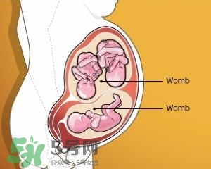 雙子宮是什么意思？雙子宮可以順產(chǎn)嗎？