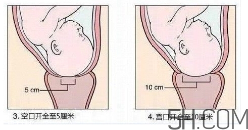 內(nèi)檢是什么感覺？內(nèi)檢有男醫(yī)生嗎？