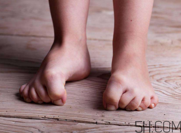 腳氣會(huì)通過床單傳染嗎？腳氣會(huì)傳染給嬰兒嗎？