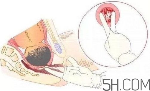 內(nèi)檢是什么感覺？內(nèi)檢有男醫(yī)生嗎？