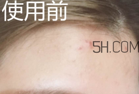 essence雙色遮瑕膏怎么用？essence雙色遮瑕膏使用心得