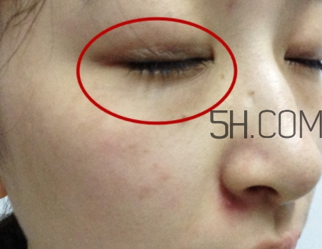 嬌韻詩(shī)眼霜孕婦可以用嗎？