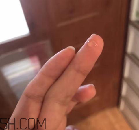 倍舒痕可以去痘印嗎？倍舒痕能涂在痘痘上嗎？