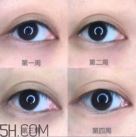 黑眼圈怎么去除既簡(jiǎn)單有容易 看類型與程度