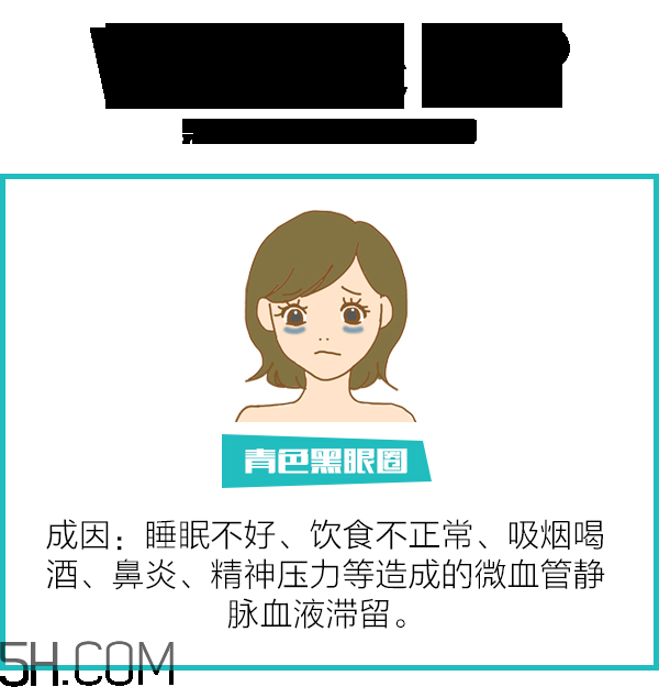 黑眼圈怎么去除既簡(jiǎn)單有容易 看類型與程度