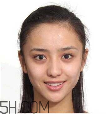 黑眼圈怎么去除既簡(jiǎn)單有容易 看類型與程度