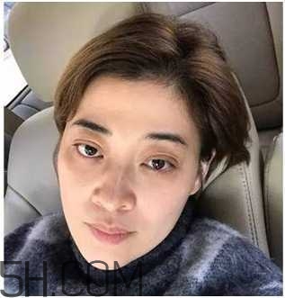 黑眼圈怎么去除既簡(jiǎn)單有容易 看類型與程度