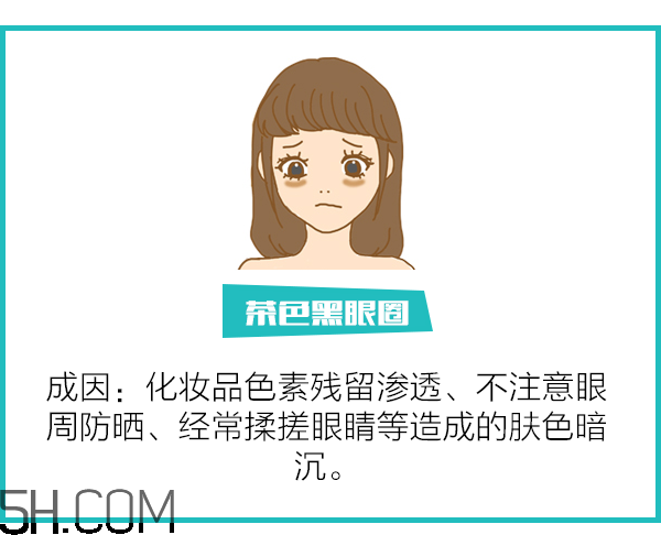 黑眼圈怎么去除既簡(jiǎn)單有容易 看類型與程度