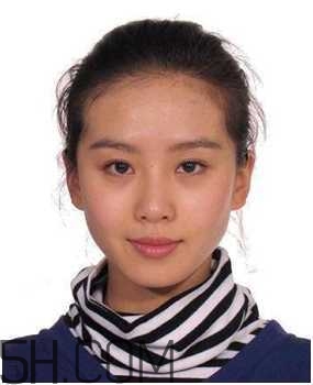 黑眼圈怎么去除既簡(jiǎn)單有容易 看類型與程度