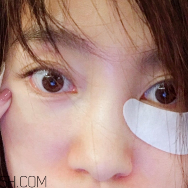 黑眼圈怎么去除既簡(jiǎn)單有容易 看類型與程度