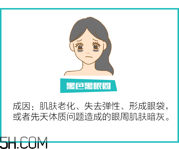黑眼圈怎么去除既簡(jiǎn)單有容易 看類型與程度