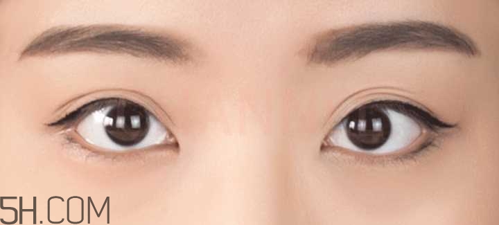 黑眼圈怎么去除既簡(jiǎn)單有容易 看類型與程度