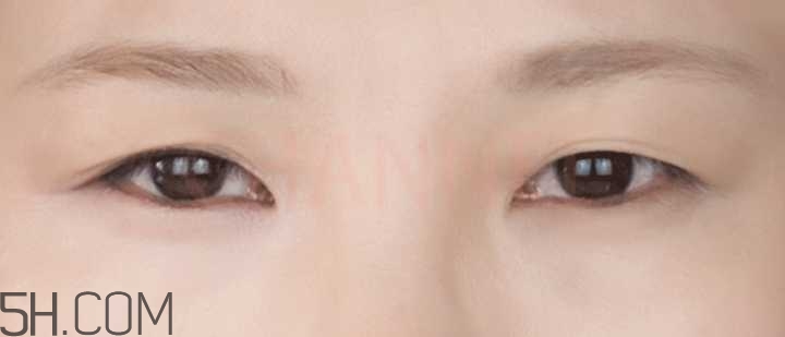 黑眼圈怎么去除既簡(jiǎn)單有容易 看類型與程度