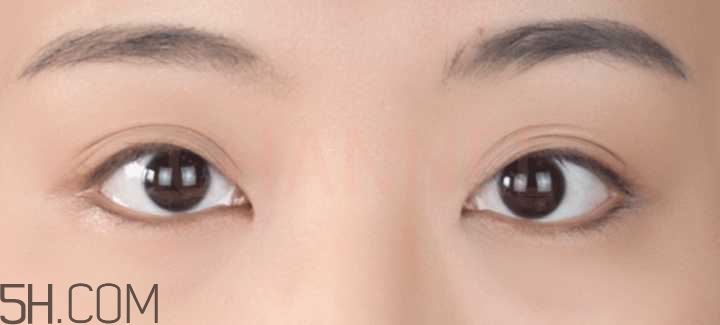 黑眼圈怎么去除既簡(jiǎn)單有容易 看類型與程度