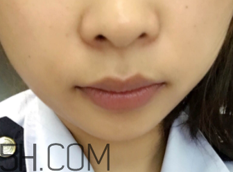 小蜜蜂細(xì)致修護(hù)唇膏很油嗎？夏天用合適嗎？