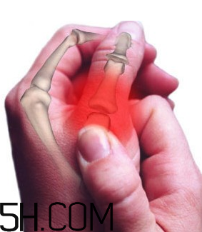 冬天關(guān)節(jié)痛怎么回事？關(guān)節(jié)痛怎么辦？