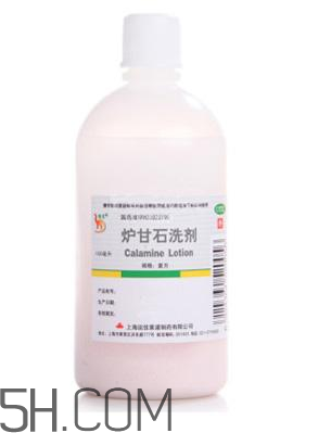 爐甘石洗劑是激素藥嗎？爐甘石洗劑是處方藥嗎？