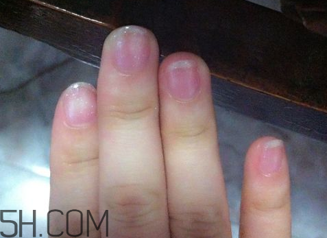 美甲后指甲受損怎么辦？指甲破損怎么修復(fù)？