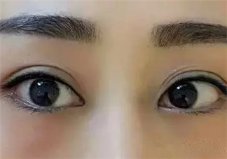 怎么紋美瞳線好看？紋美瞳線的危害