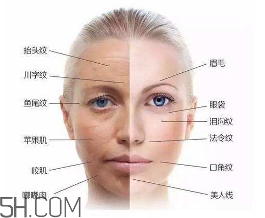 怎么預(yù)防皺紋的產(chǎn)生？導(dǎo)致皺紋的產(chǎn)生的原因有哪些？