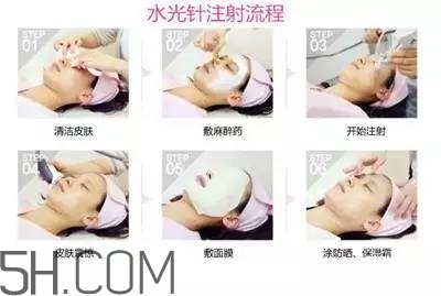 打水光針多久打一次？水光針的誤區(qū)