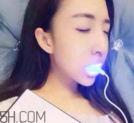 美牙儀可以兩個人用嗎？美牙儀用多久才有作用？