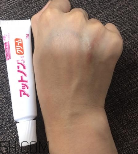 小林制藥祛疤膏有效嗎？小林制藥祛疤膏怎么樣？