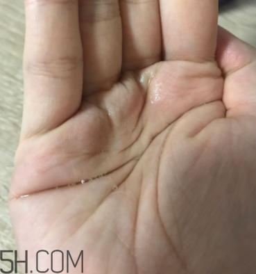 雪肌精卸妝油糊眼睛嗎？雪肌精卸妝油悶痘嗎？