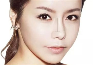 達(dá)拉斯隆鼻是什么材料？達(dá)拉斯隆鼻怎么樣？