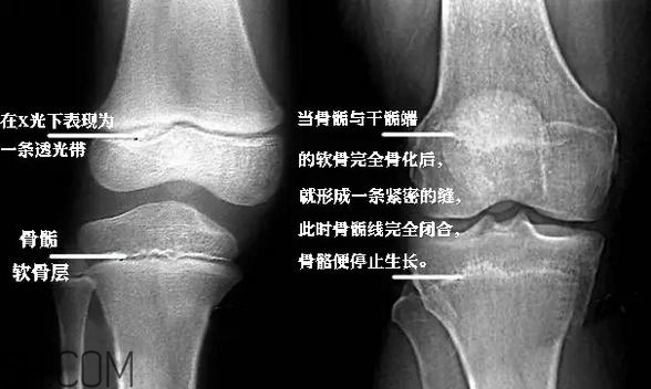 孩子學(xué)街舞好不好？學(xué)街舞好處多多