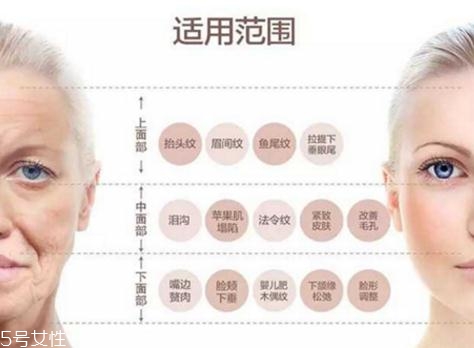 大v線會(huì)斷嗎？一定要選擇正規(guī)整形醫(yī)院